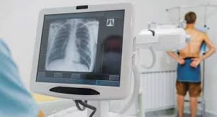 Radiography Systems